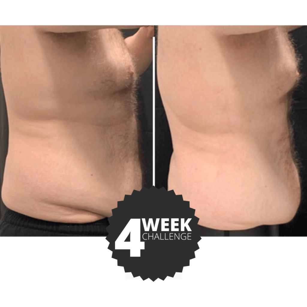 Bodcor Body Contouring Treatments for Men and Women