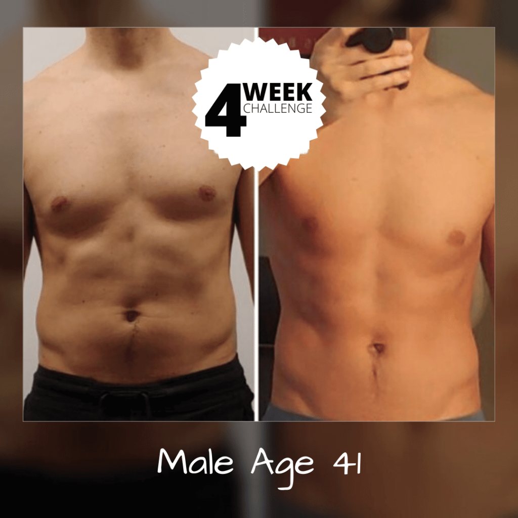 Body Contouring Treatments for Men and Women