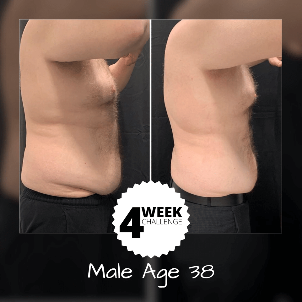 Body Contouring Treatments for Men and Women